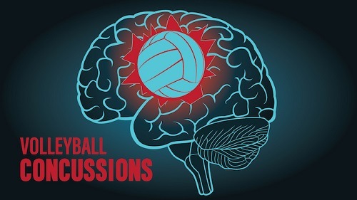 Voleybolda beyin sarsıntısı sorunu var